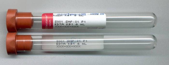 Labeling exercise 8-1 patient id and blood specimen label